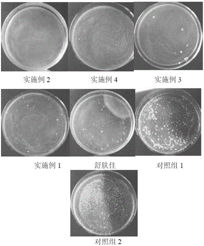 Application of rose aqueous extracts to preparing malassezia-prevention medicine or soap