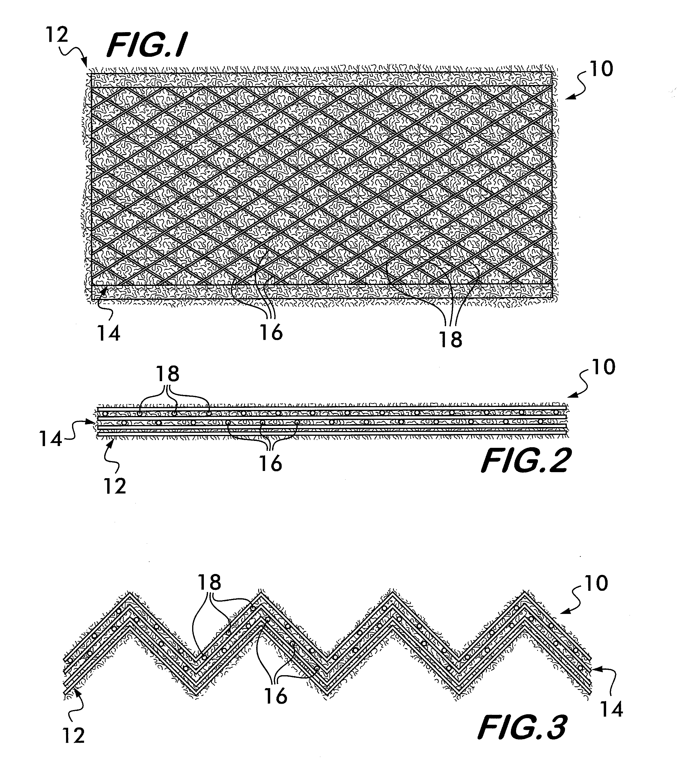 Reinforced, pleated filter structure