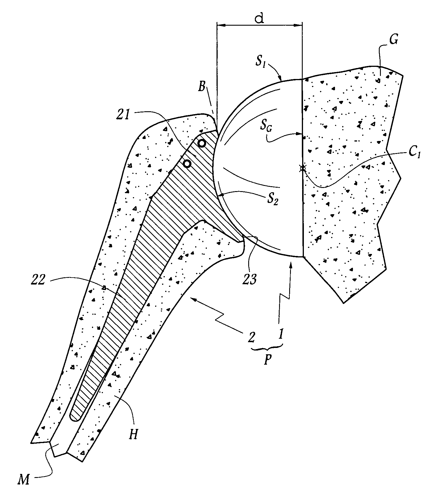 Total shoulder prosthesis or inverted type