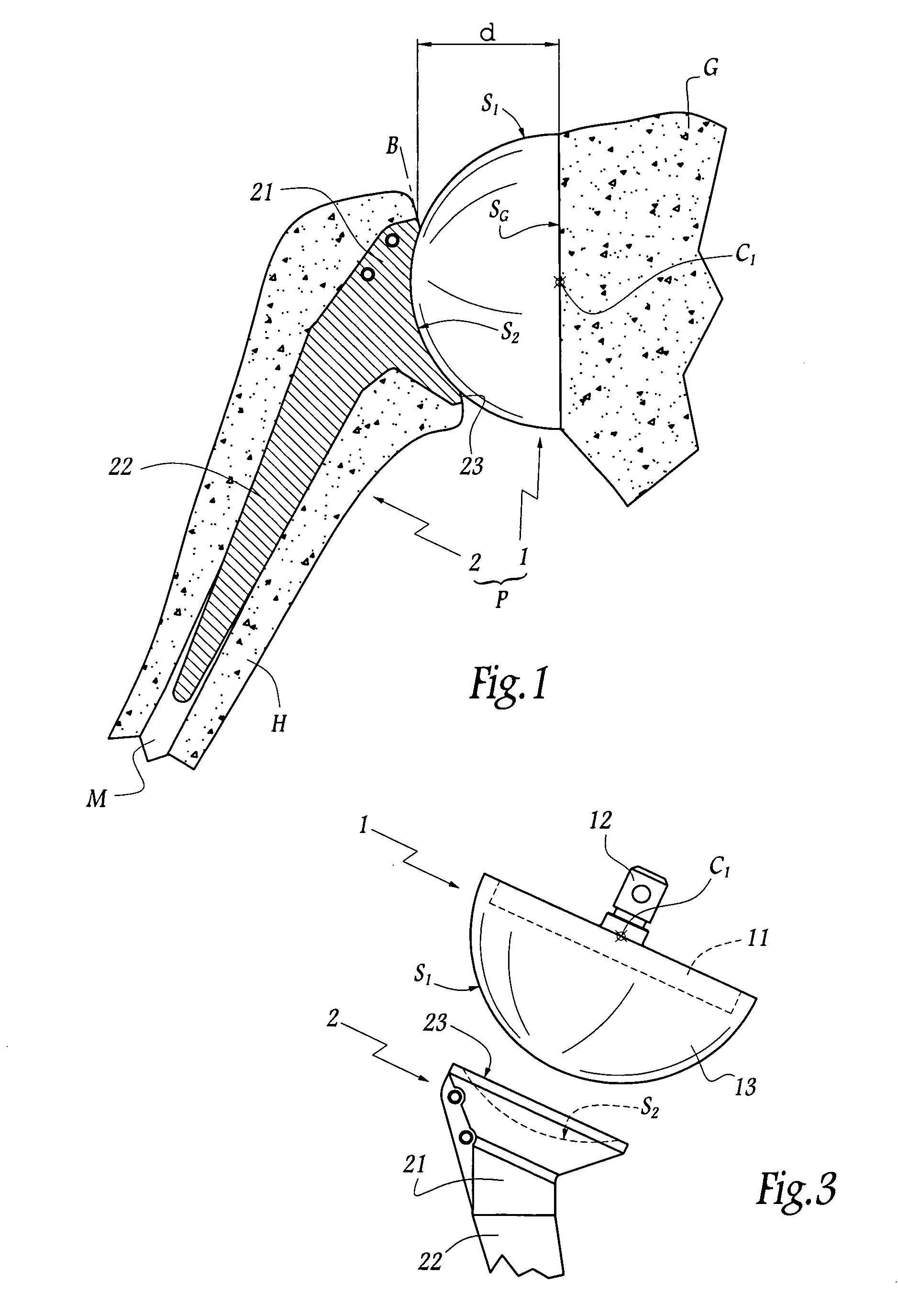 Total shoulder prosthesis or inverted type