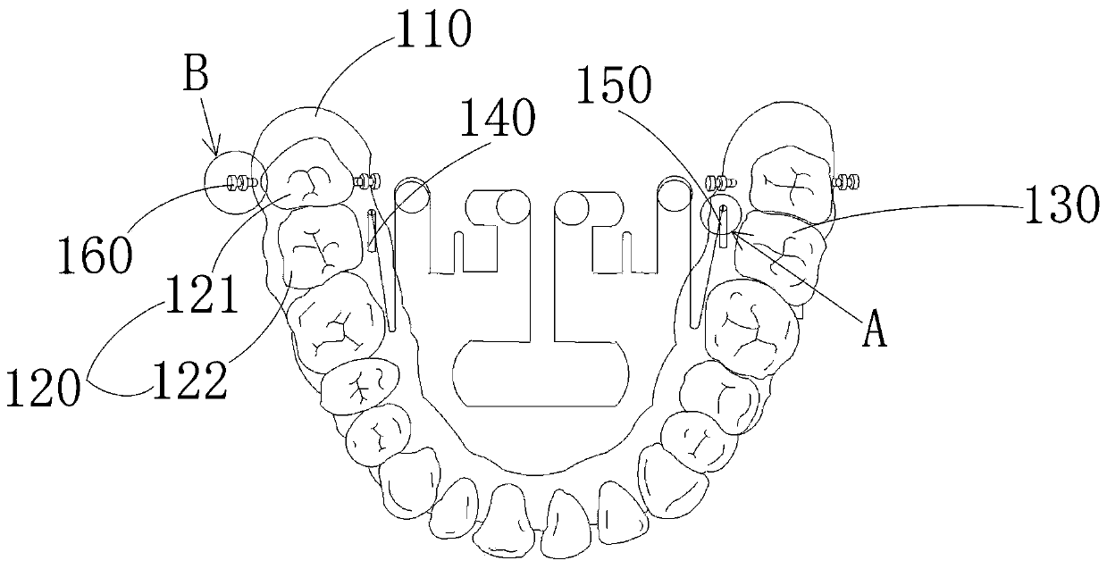 Molar depressing device