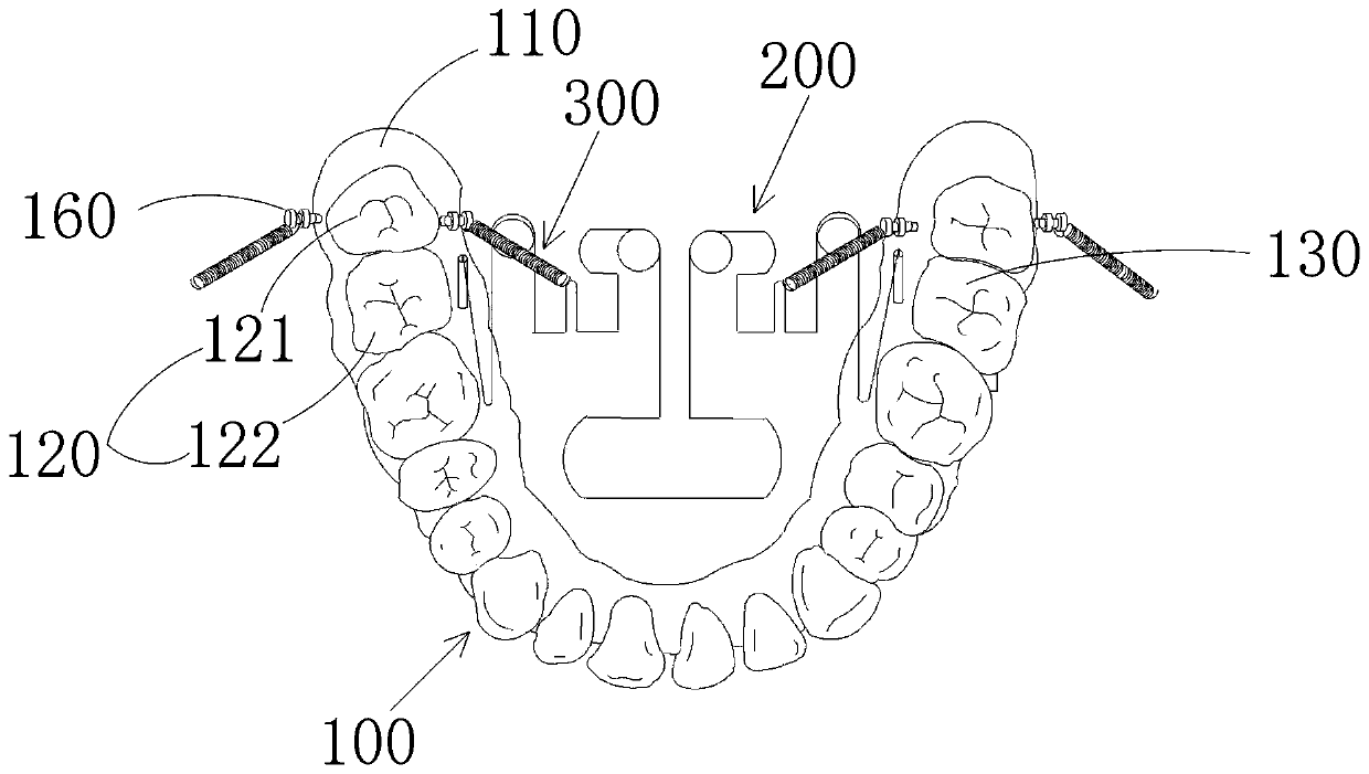 Molar depressing device