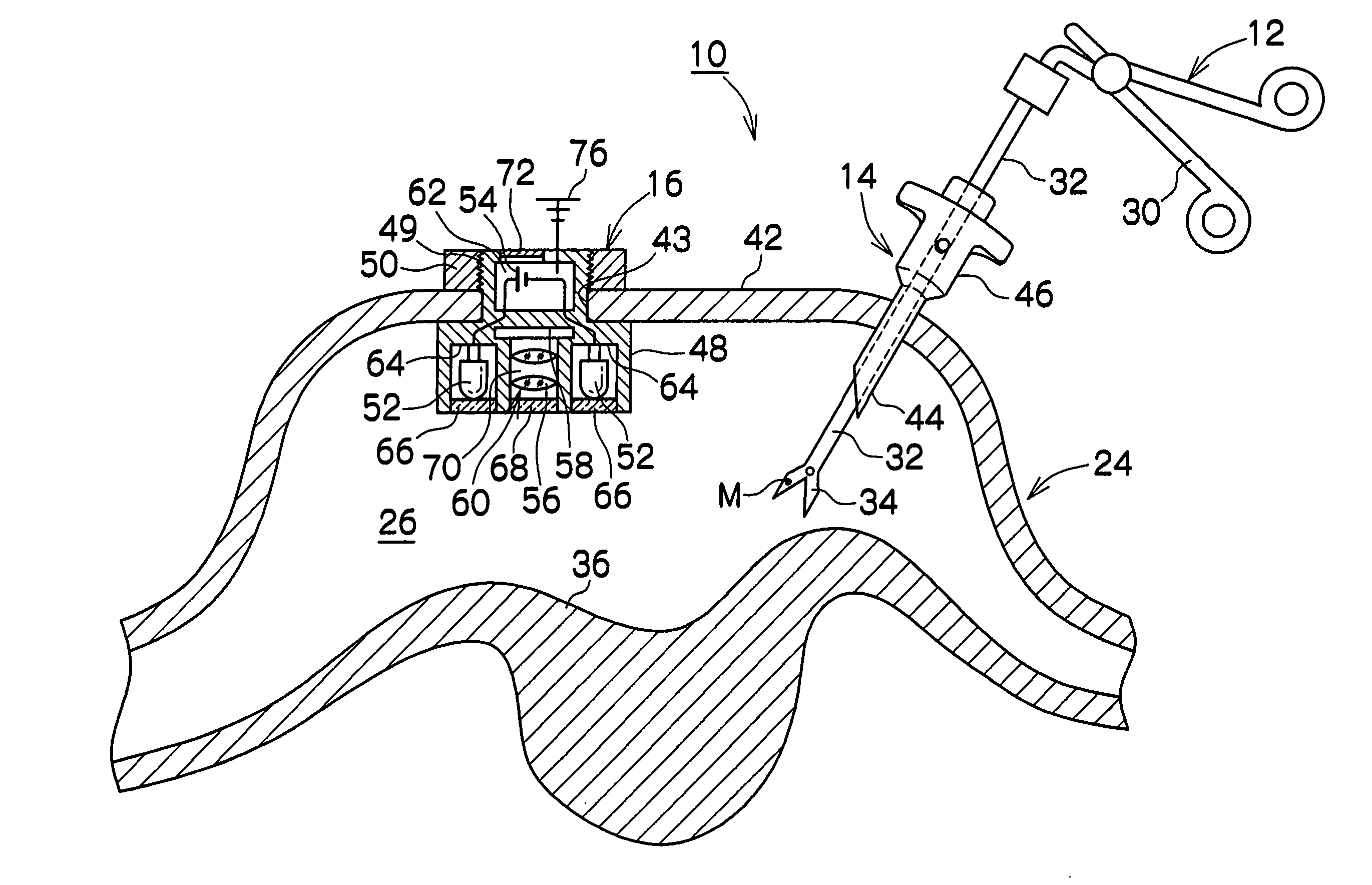 Body cavity observation apparatus