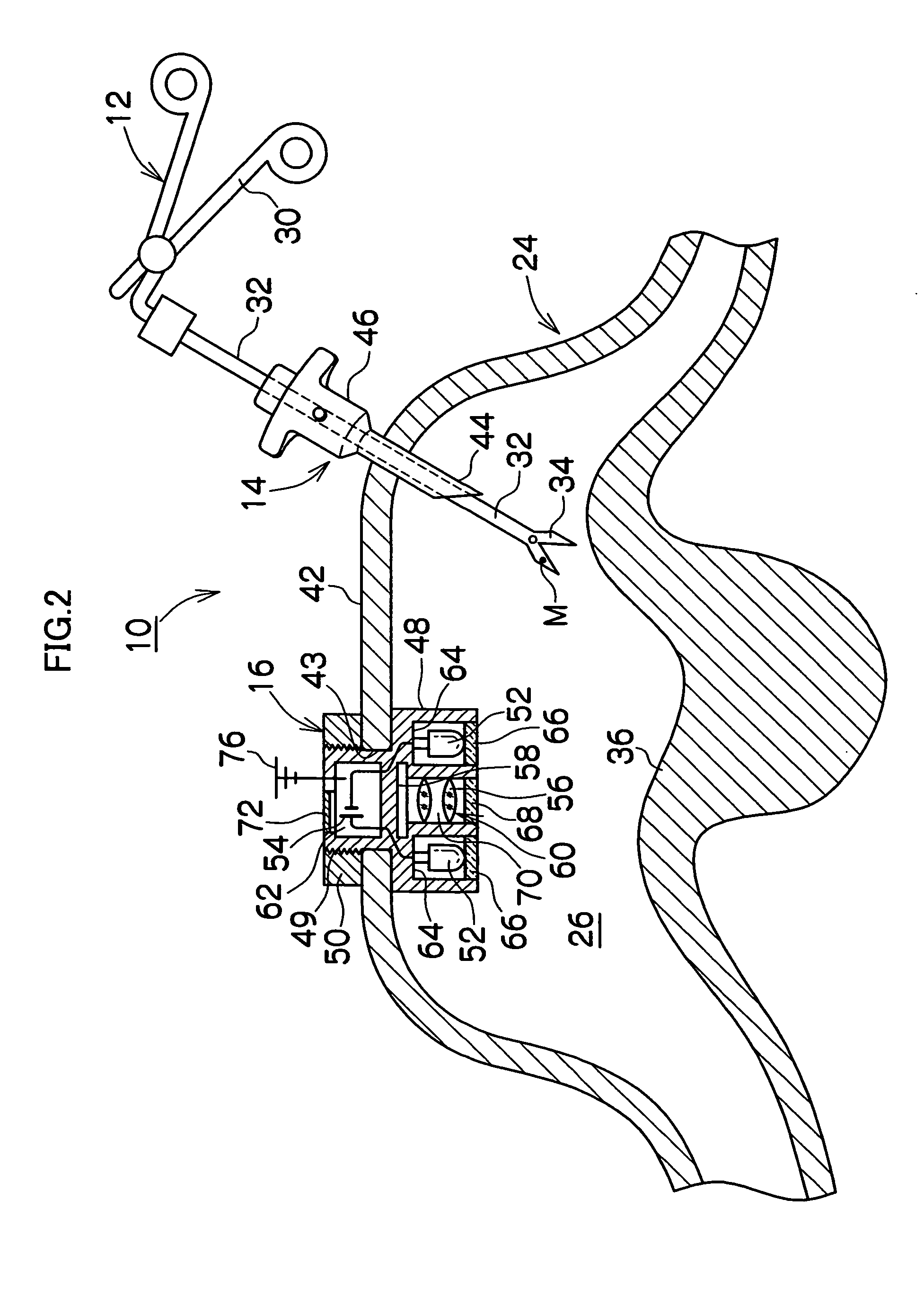 Body cavity observation apparatus