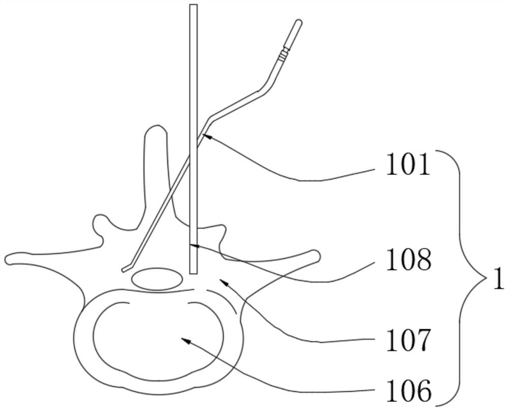 Hard mater protection plate with single-side admission passage and opposite-side pressure reduction