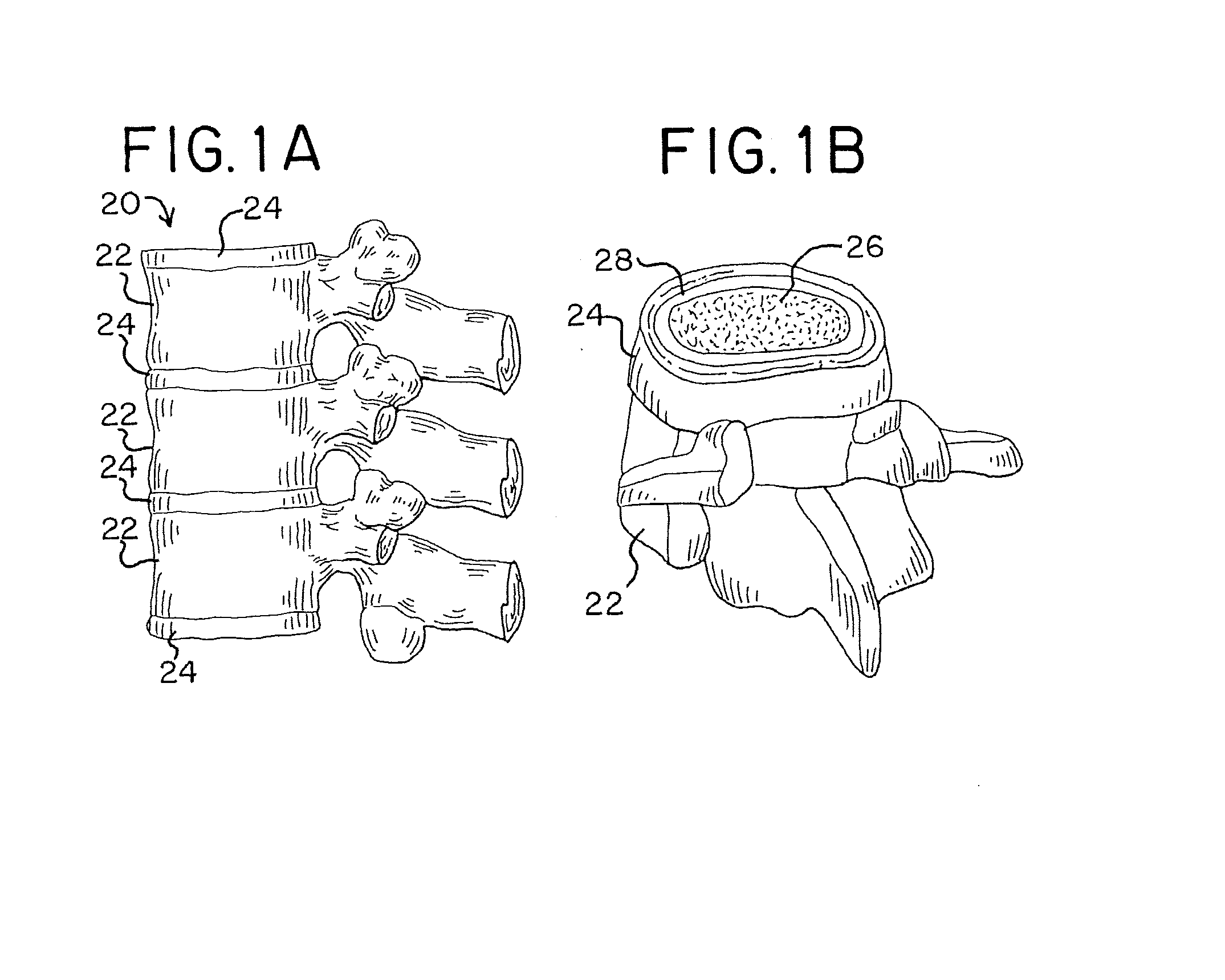 Apparatus and methods for disrupting intervertebral disc tissue