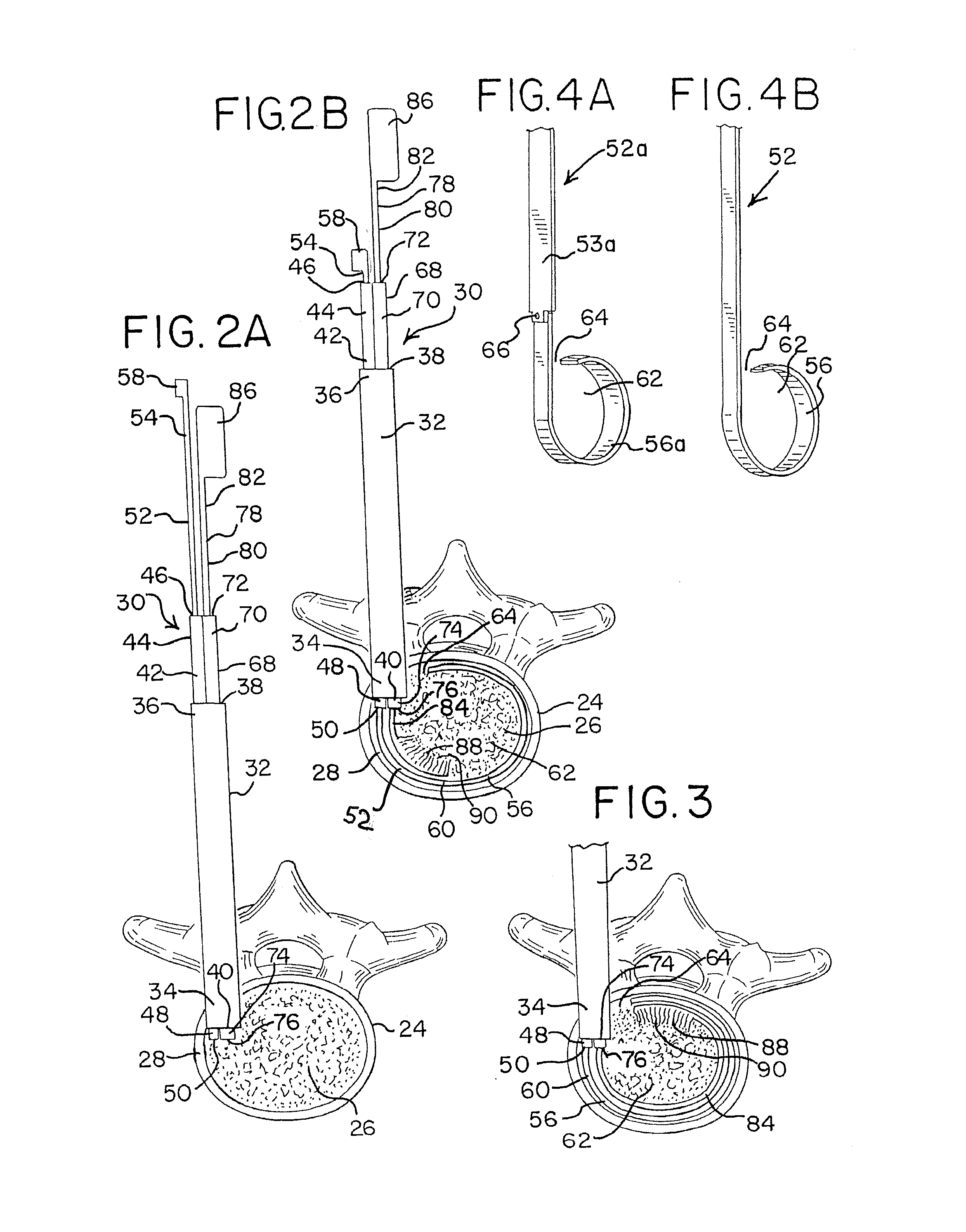 Apparatus and methods for disrupting intervertebral disc tissue