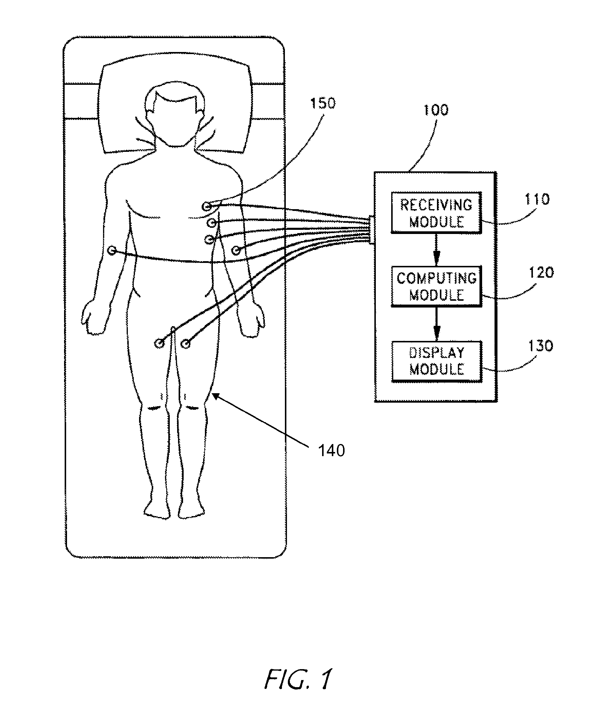 System and method for separating cardiac signals