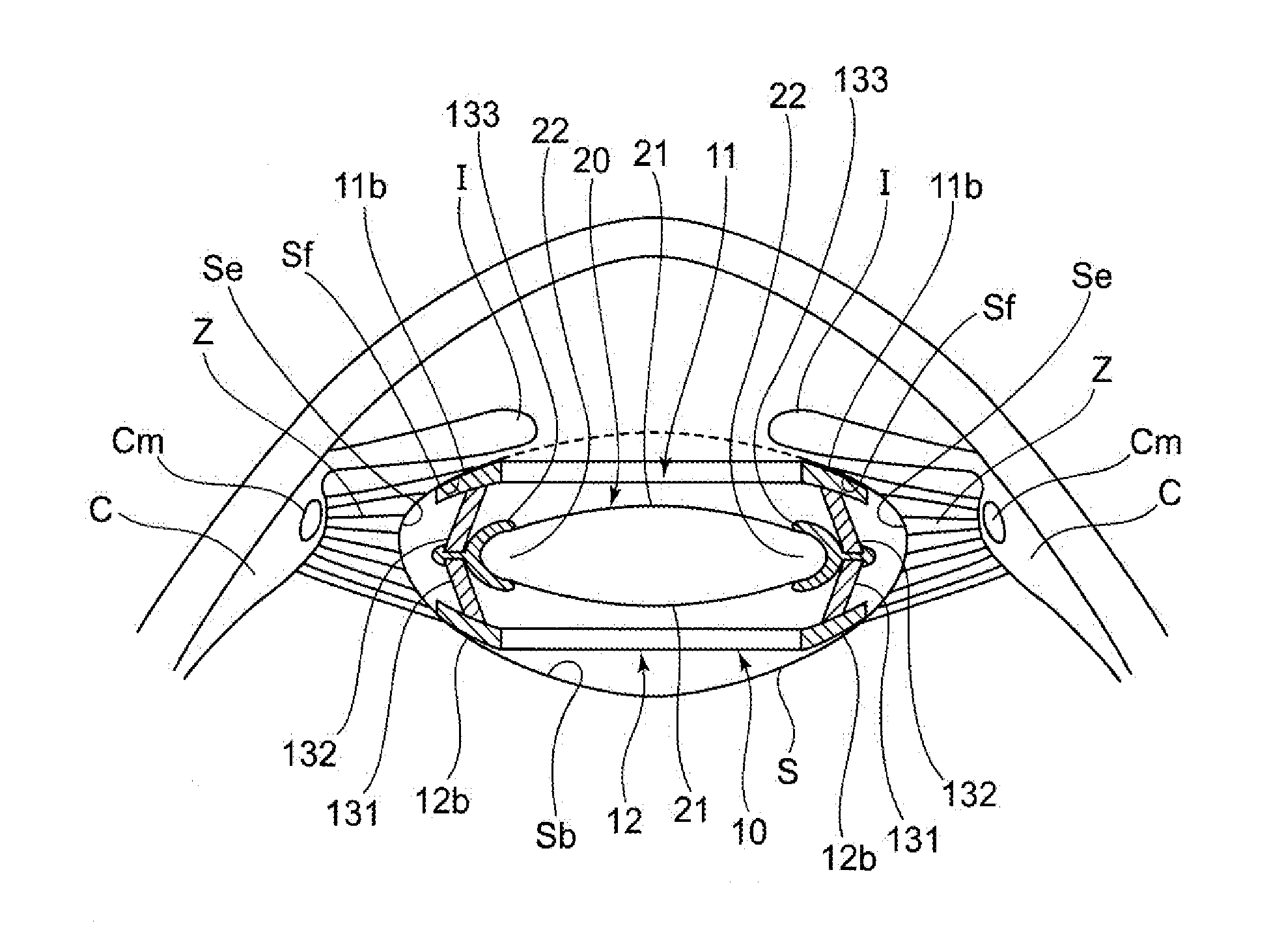 Accommodating intraocular lens