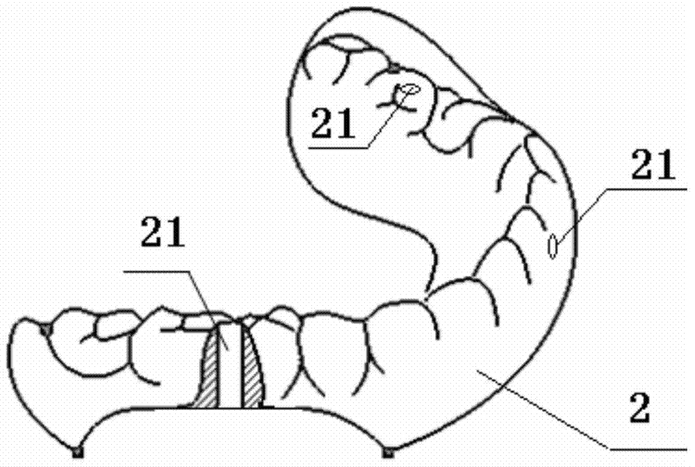 Dental implant surgery guide plate for complete tooth loss and manufacturing method thereof