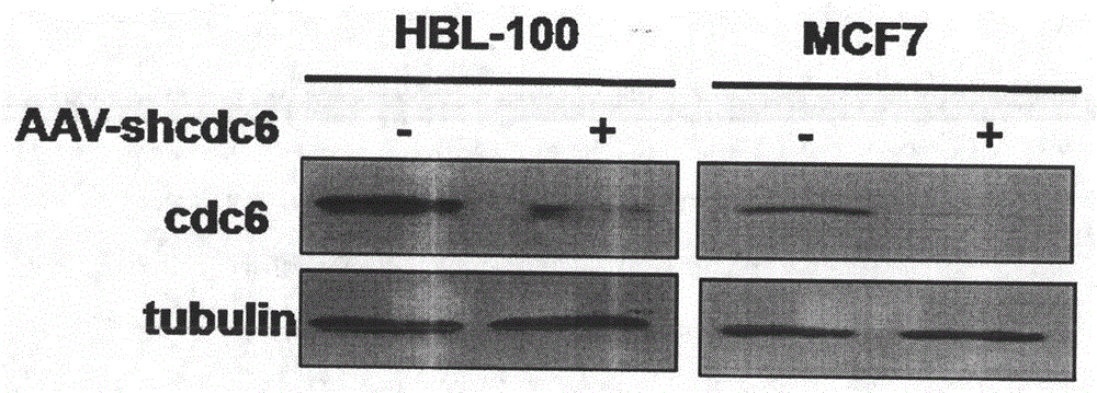 Recombinant adeno-associated virus aav-shcdc6 preparation, its preparation and application