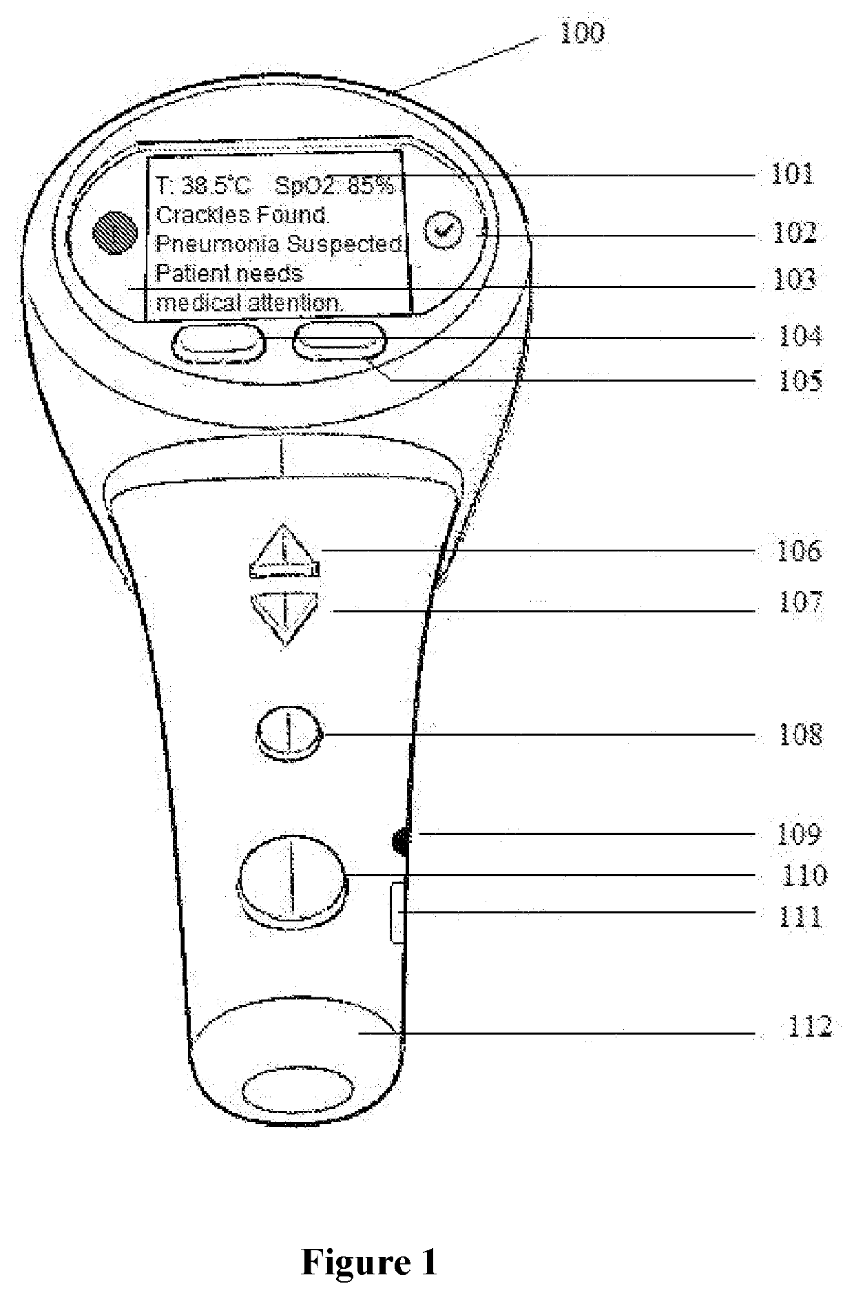 An intelligent cardio pulmonary screening device for telemedicine applications