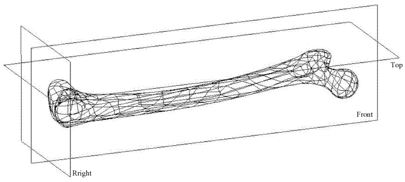 Layered quick design and manufacturing method for individualized artificial bone injection and solidification molding die