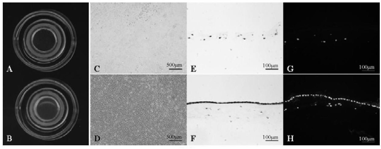 Amnion-based biological material and preparation method and uses thereof