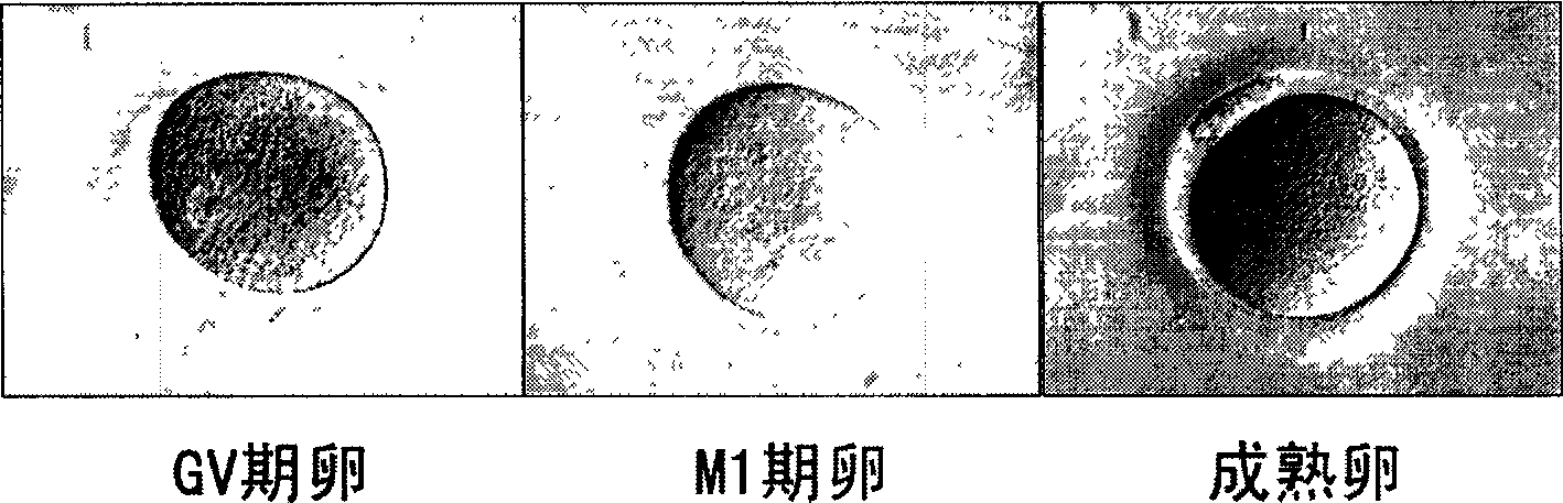 In vitro maturing culture method for human immature ovum