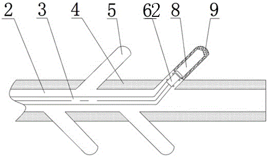 A drilling, completion and stimulation system for drilling fishbone-shaped multi-level branched horizontal wells in shale gas reservoirs