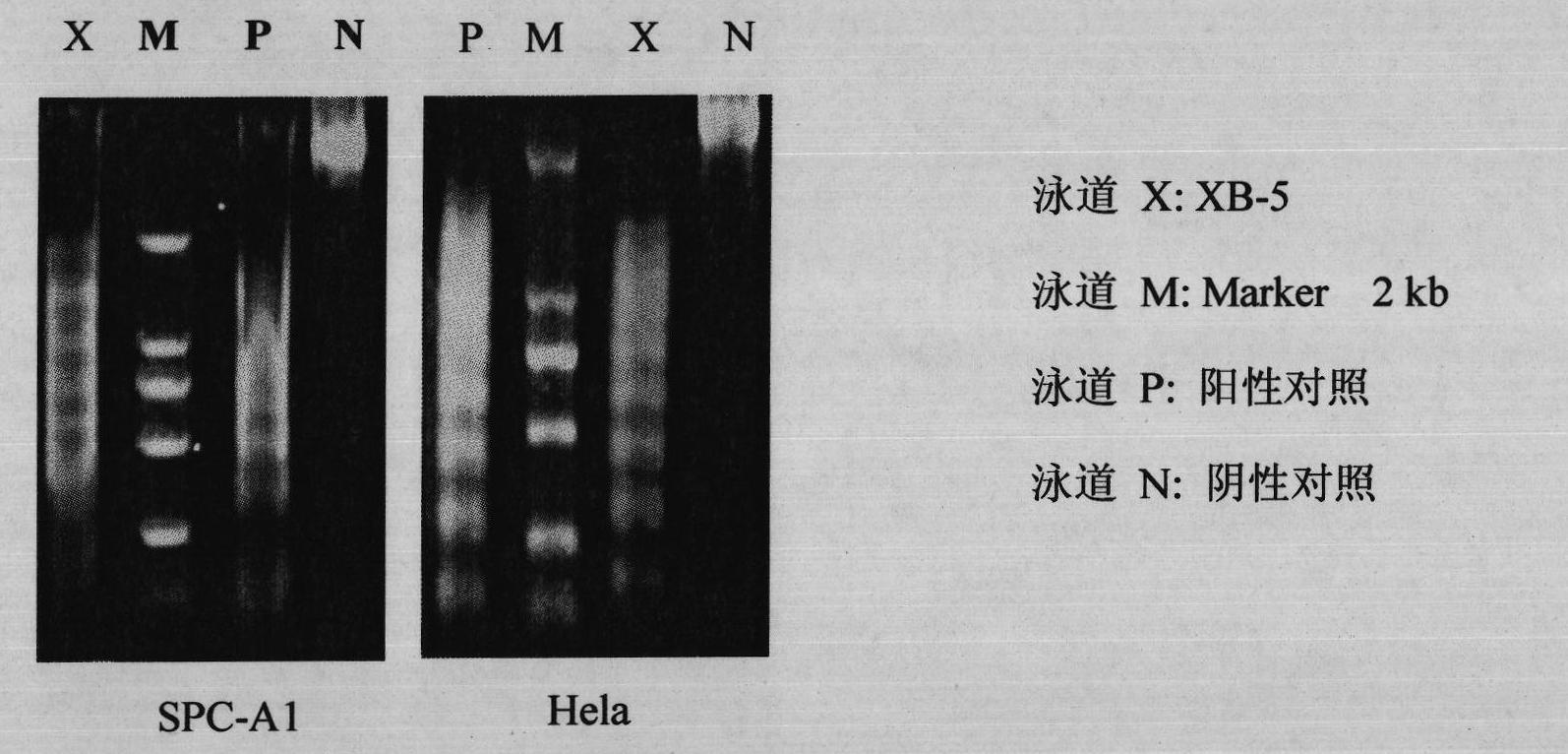 Application of conyza blinii total saponins for preparing anti-neoplastic drug