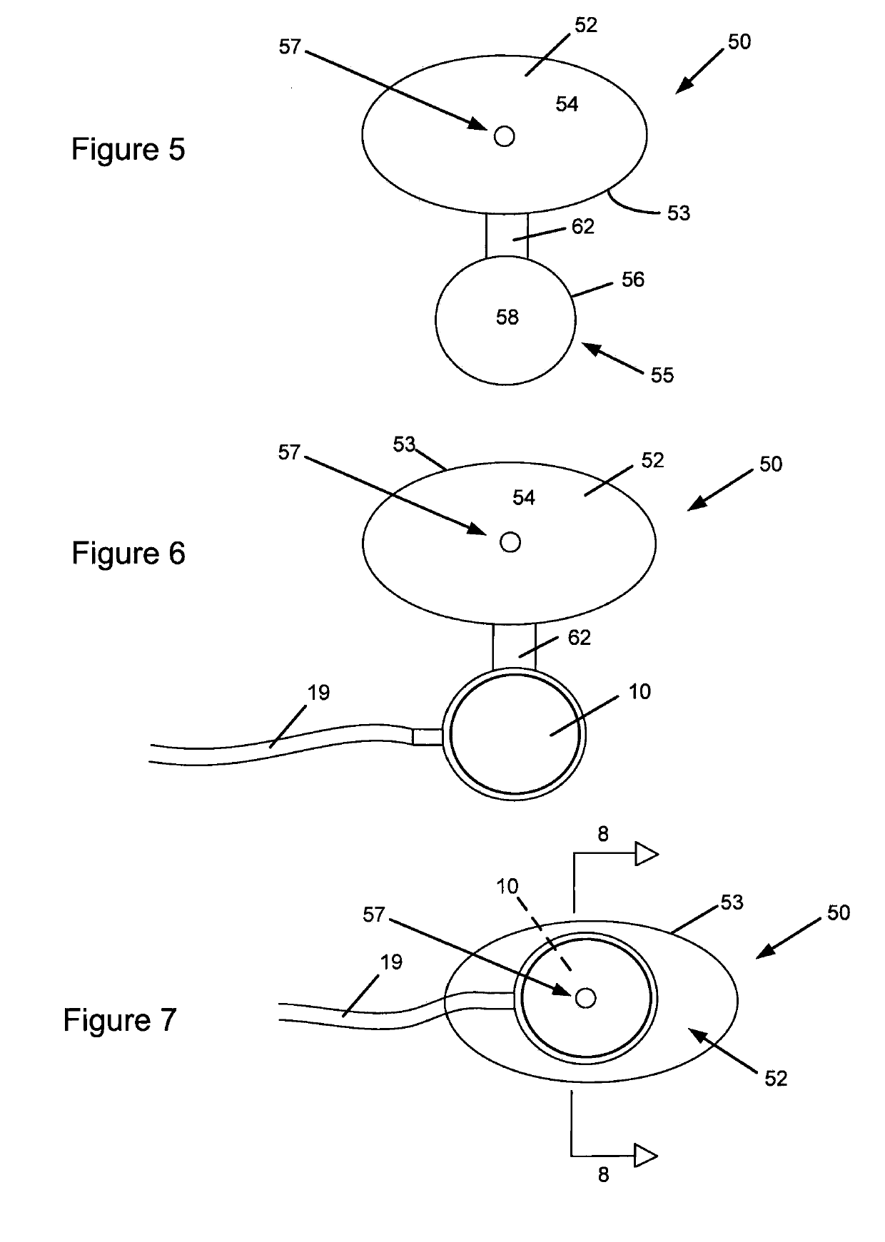 Actuator for delivery of vibratory stimulation to an area of the body and method of application