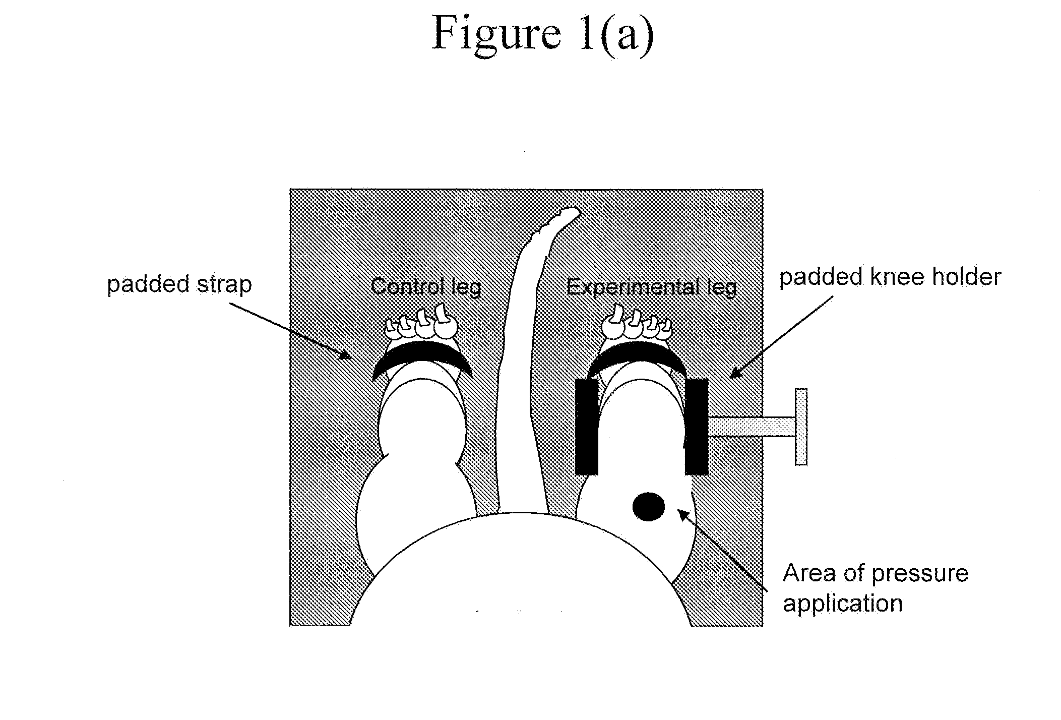 Mitigation of pressure ulcers using electrical stimulation