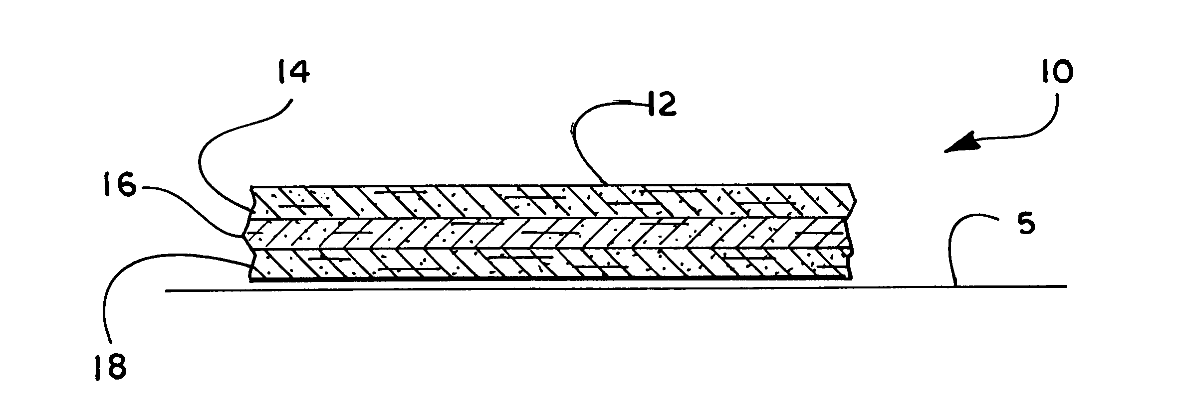 Multilayer conductive appliance having wound healing and analgesic properties