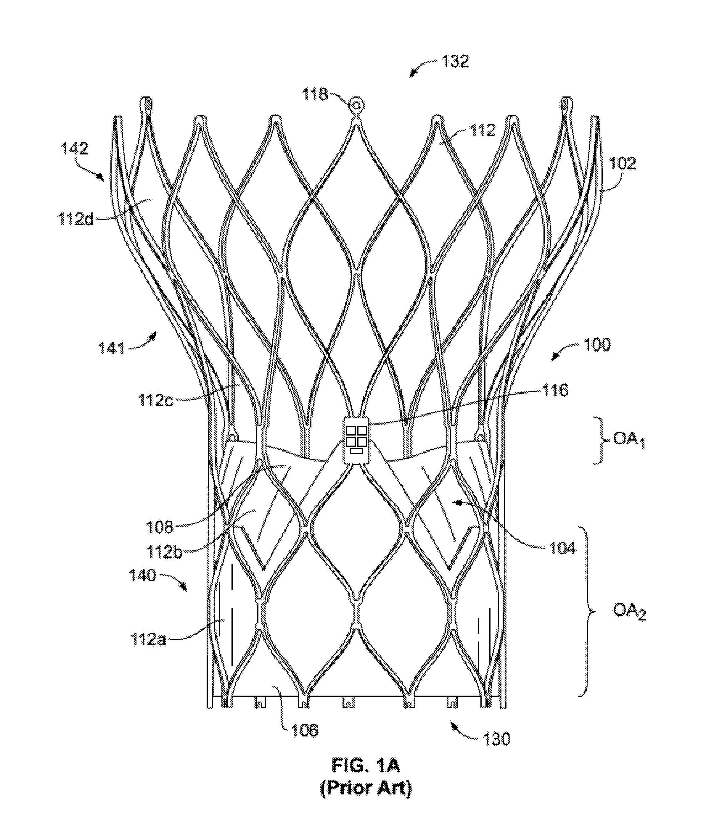 Reduced profile prosthetic heart valve