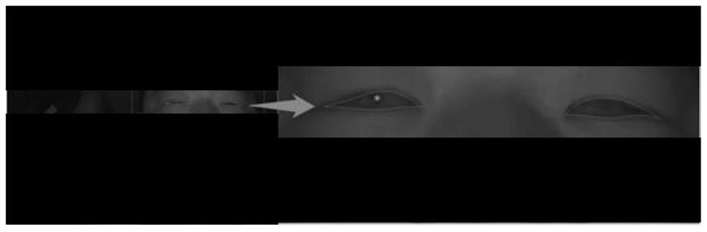 Marking of eye key points and training method and device for its detection model