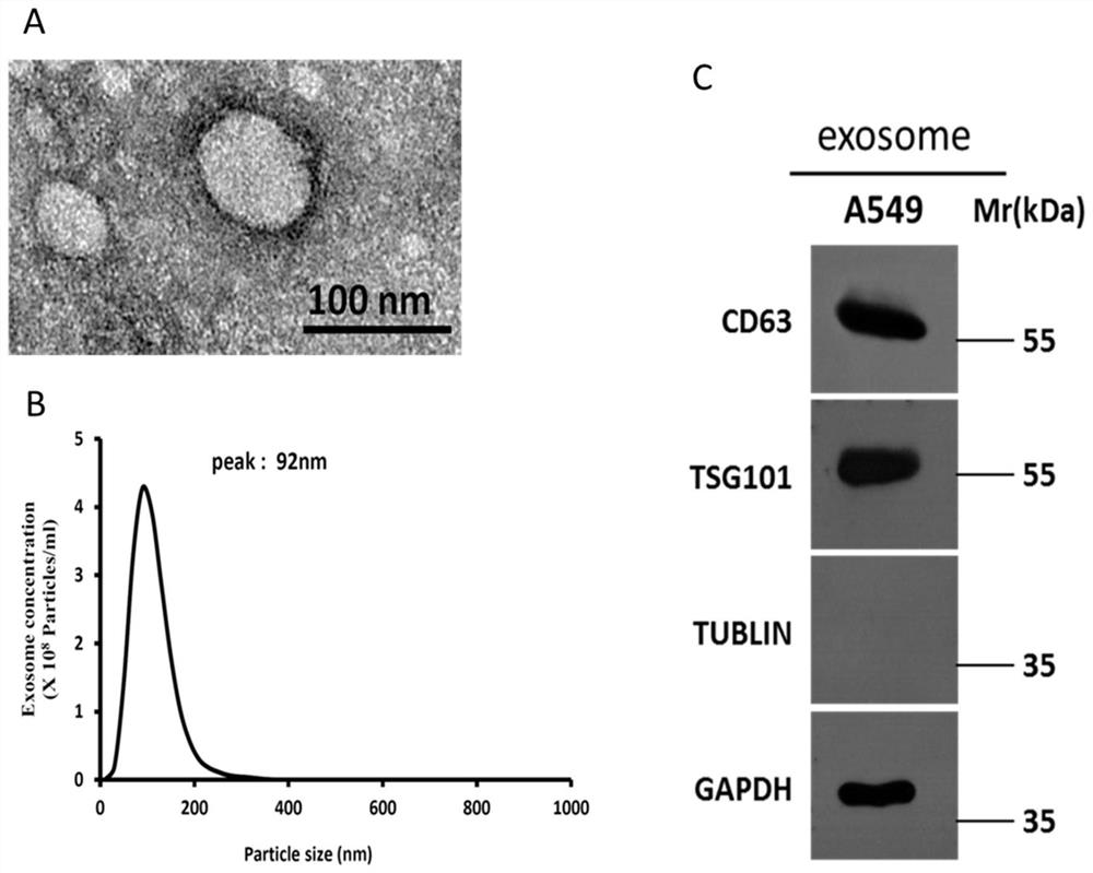 Exosome-specific miRNAs and their target genes and applications in lung adenocarcinoma