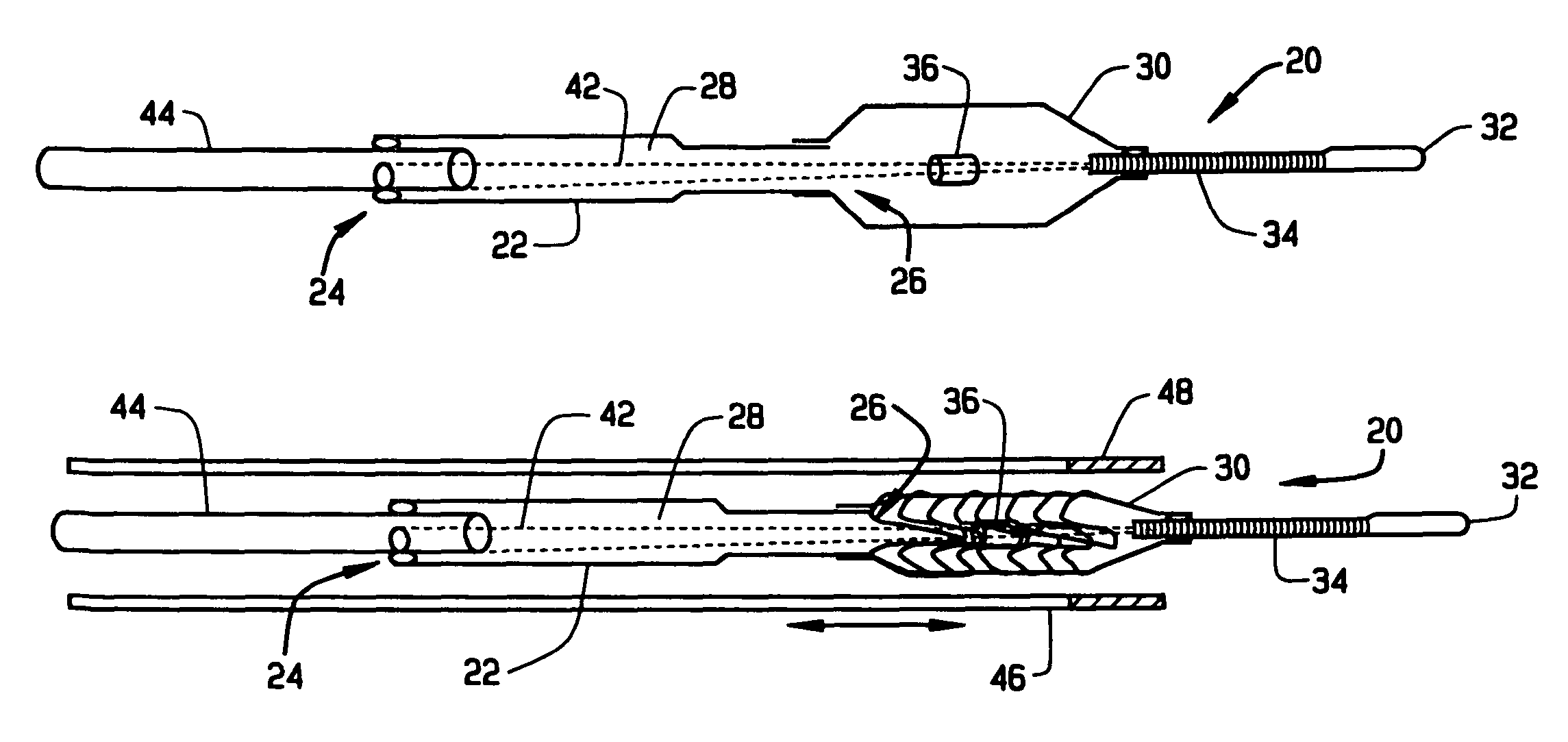 Magnetically navigable balloon catheters