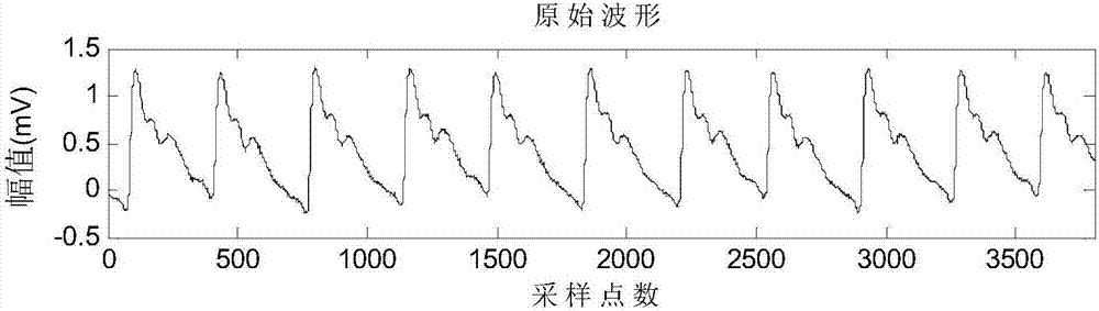 Pulse wave signal denoising method based on DTCWT-Spline