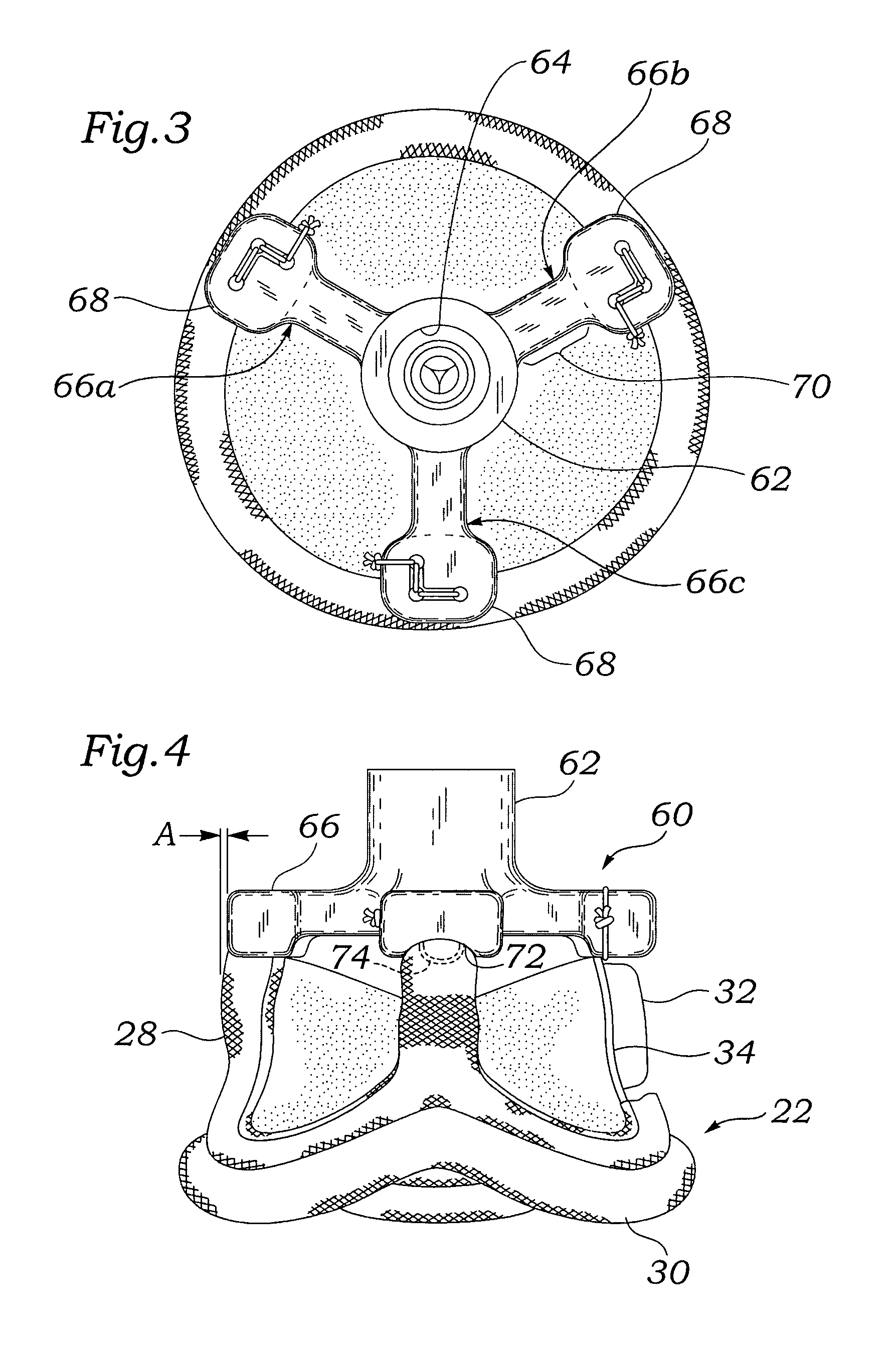 Holders for prosthetic aortic heart valves