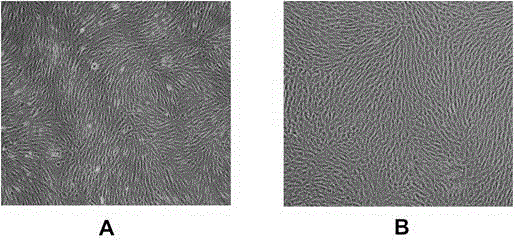 A kind of serum-free fibroblast culture medium and preparation method thereof