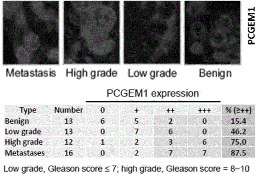 Modified LNA oligonucleotide for targeting lncRNAs to resist AR-related tumor castration-recurrent