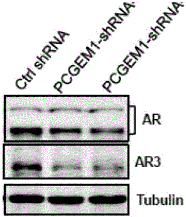 Modified LNA oligonucleotide for targeting lncRNAs to resist AR-related tumor castration-recurrent