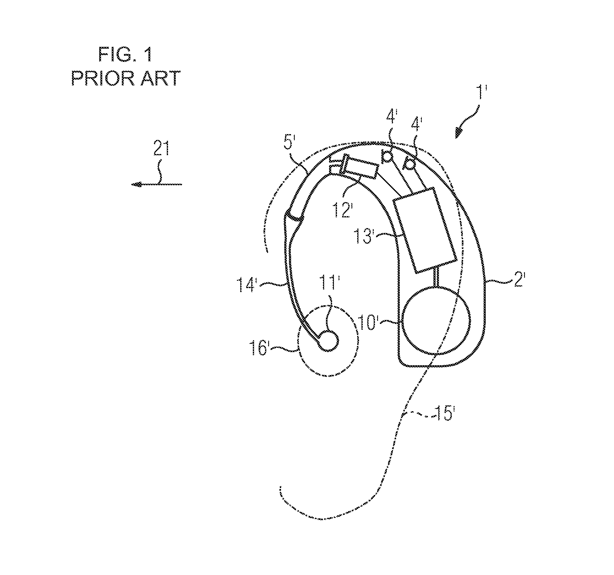 Hearing device with reduced acoustic wind sensitivity