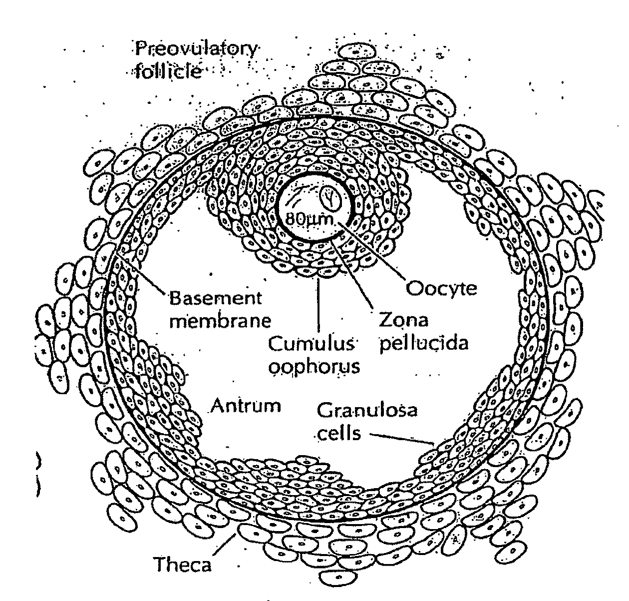 Methods for the Diagnosis and Treatment of Female Infertility Using Molecular Markers