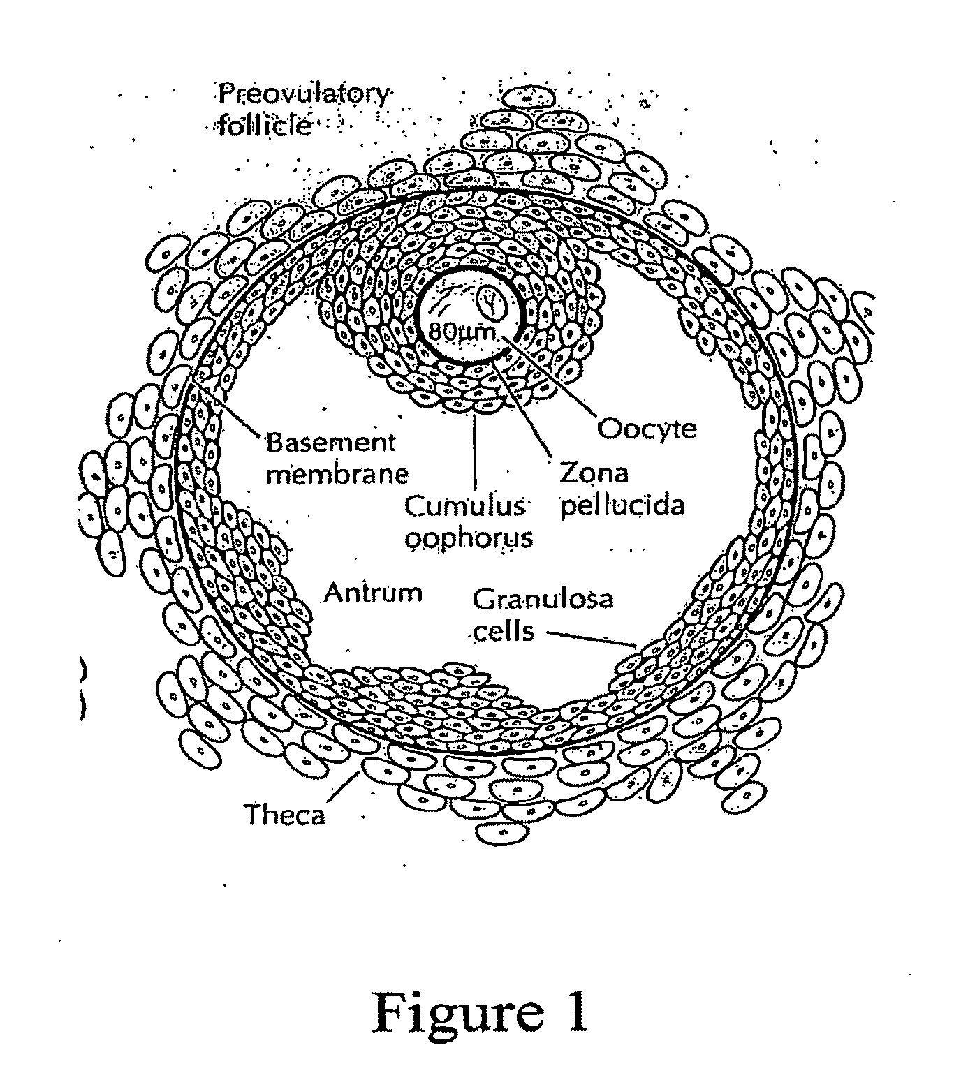 Methods for the Diagnosis and Treatment of Female Infertility Using Molecular Markers