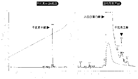 Recombinant human interferon injection and preparation method thereof