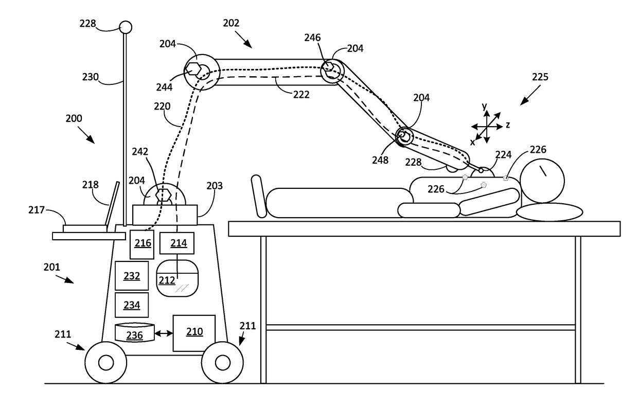 Robotic Intraoperative Radiation Therapy