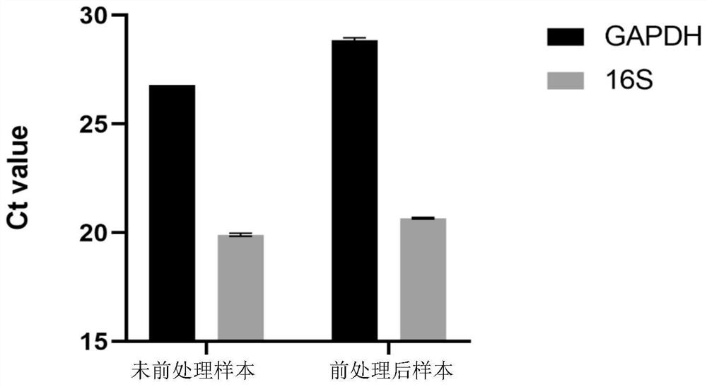 Method for efficiently removing host nucleic acid in blood flow infection sample