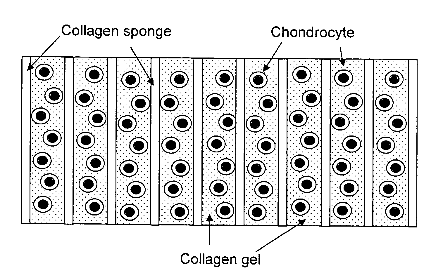 Method for in situ repair of injured, damaged, diseased or aged articular cartilage