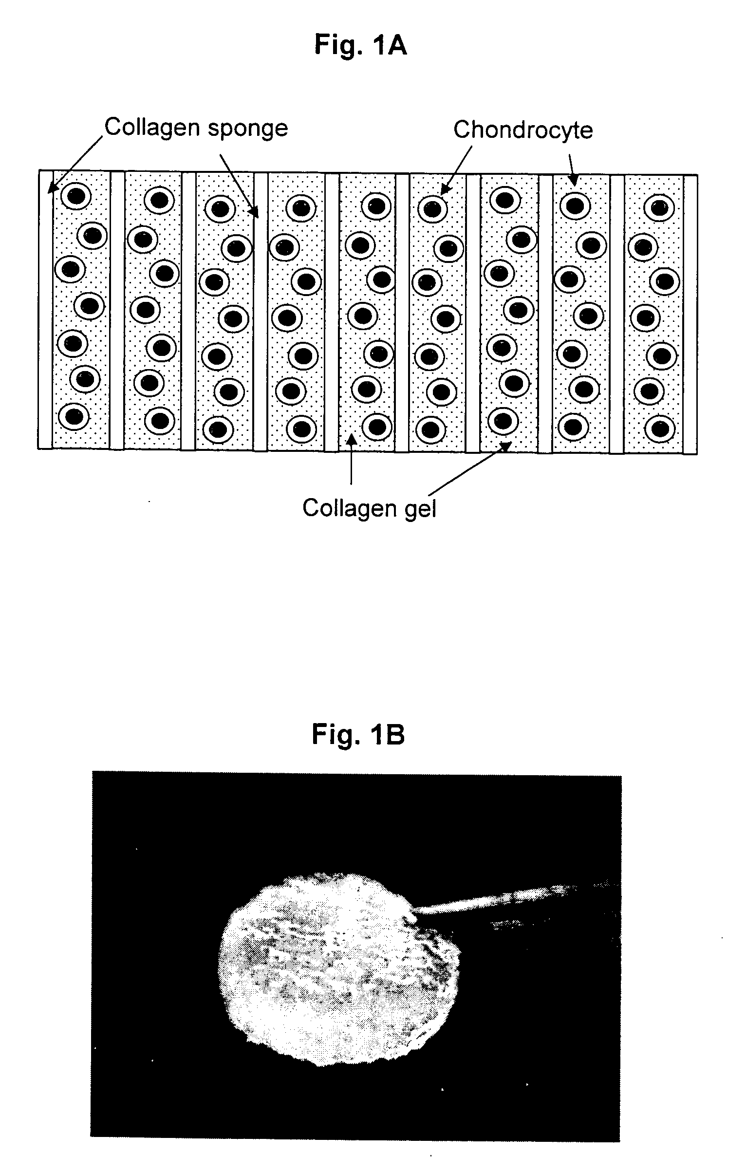 Method for in situ repair of injured, damaged, diseased or aged articular cartilage