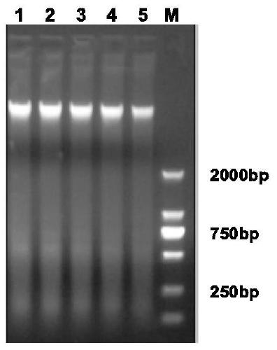 Sudden Cardiac Death Mutation Gene Detection Kit