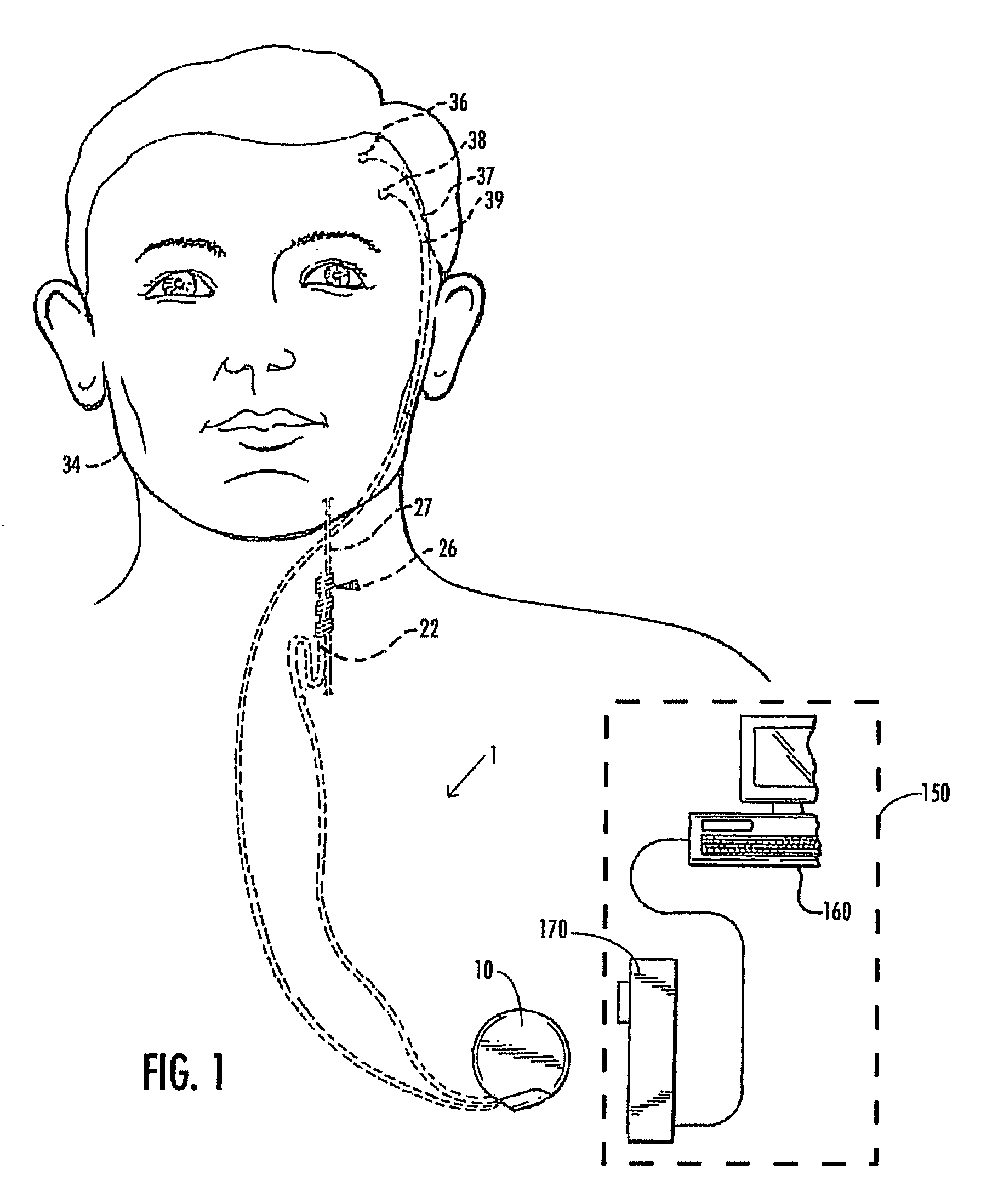 Selective neurostimulation for treating epilepsy