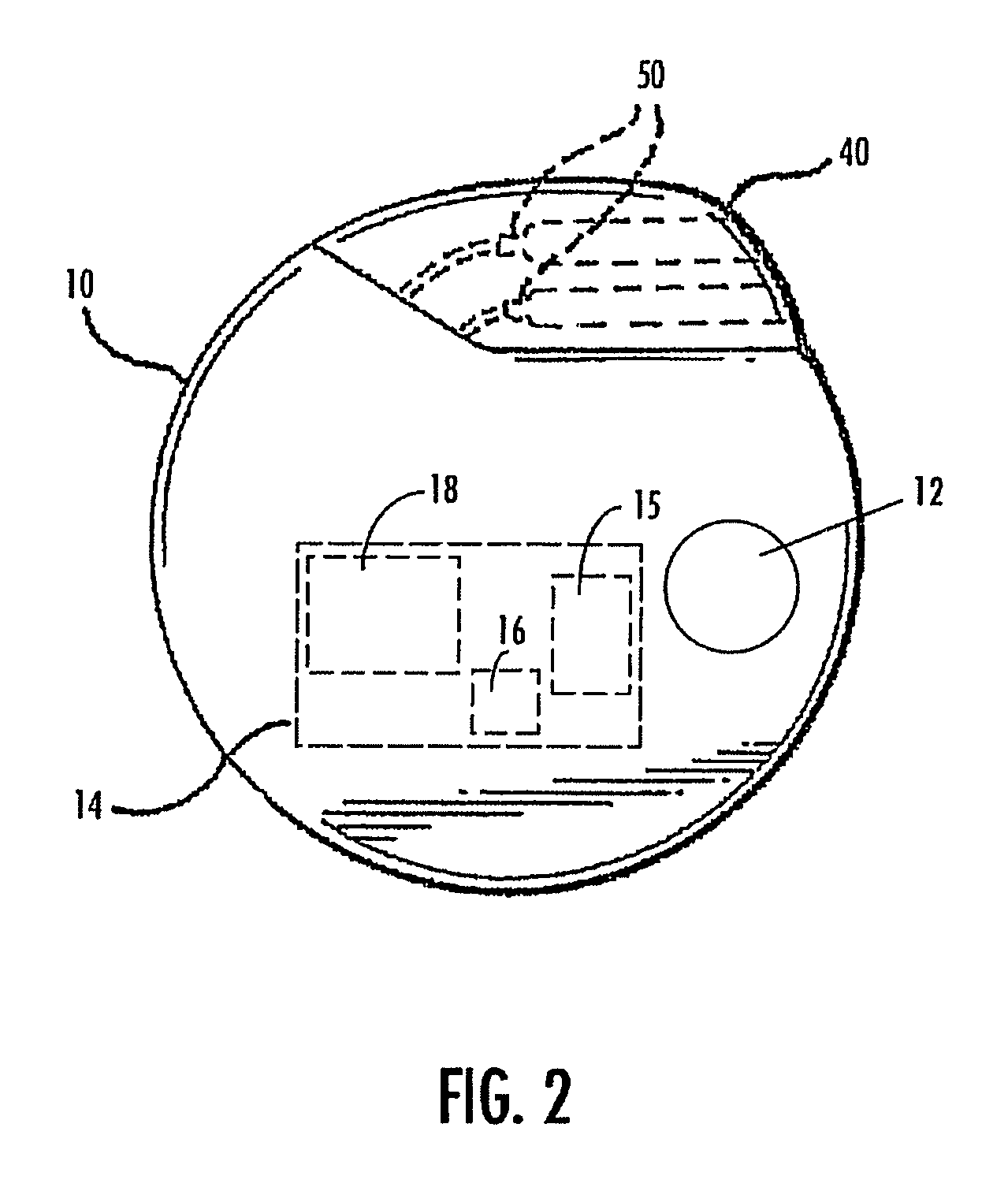 Selective neurostimulation for treating epilepsy