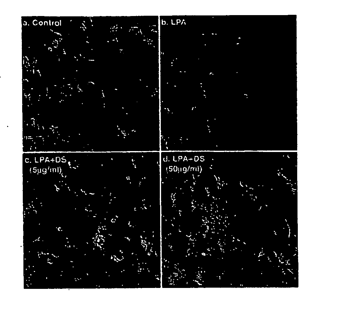 Method for Treating or Inhibiting the Effects of Injuries or Diseases that Result in Neuronal Degeneration