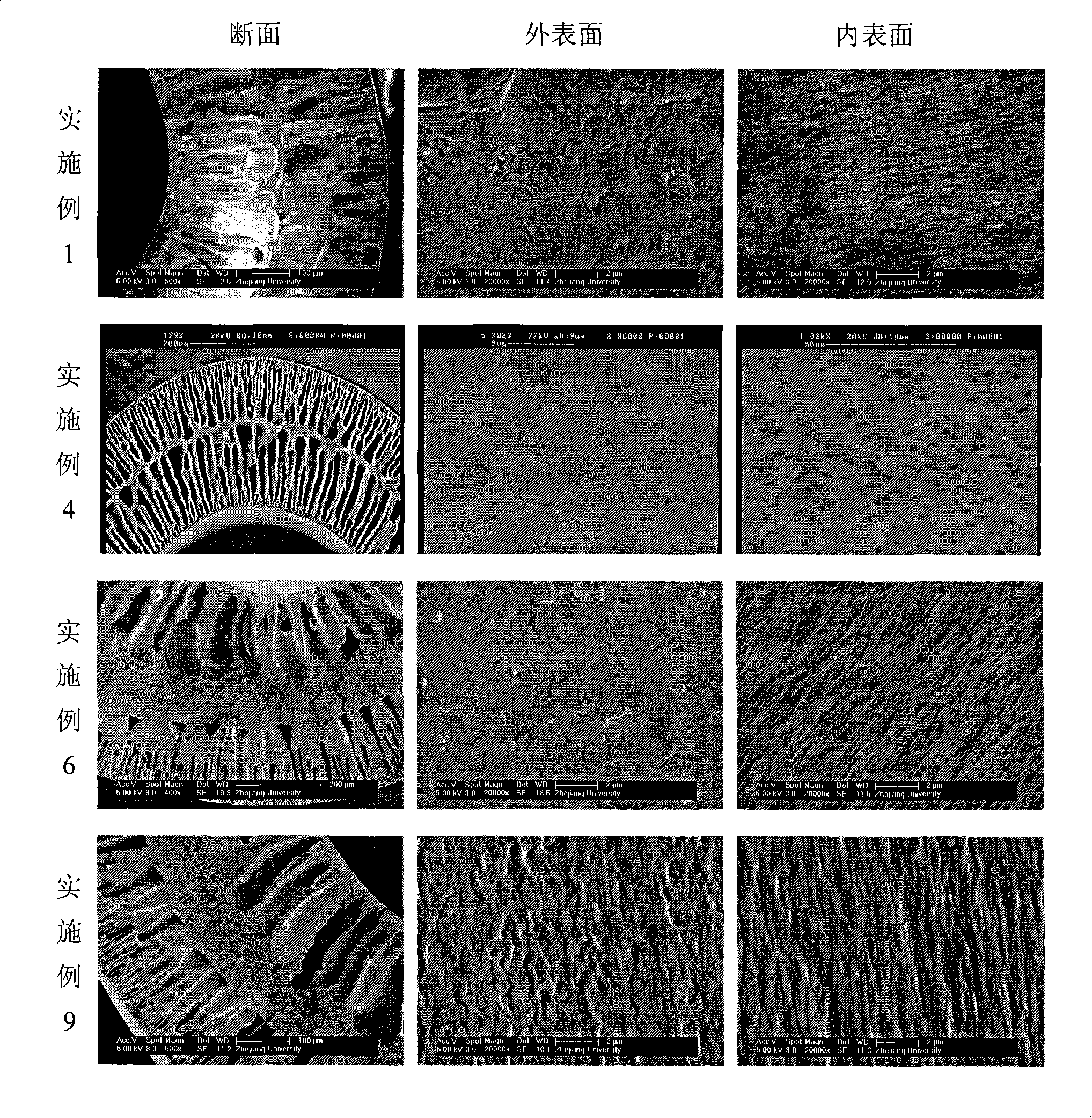 Hydrophilic polyvinyl chloride alloy ultrafiltration membrane and production method thereof