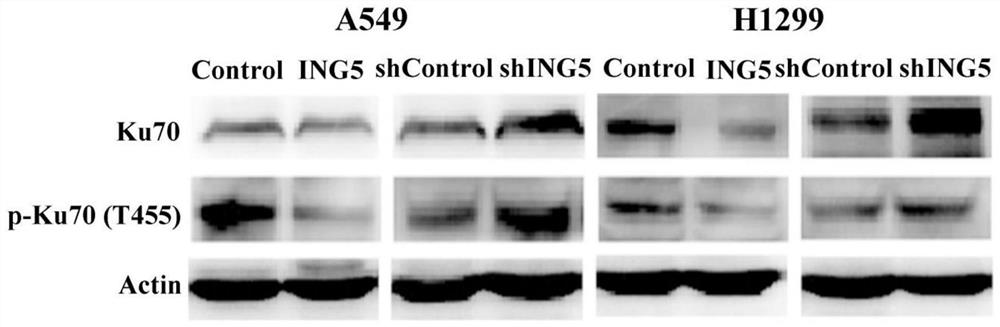 Ku70 protein T455 site phosphorylation inhibitor and application thereof