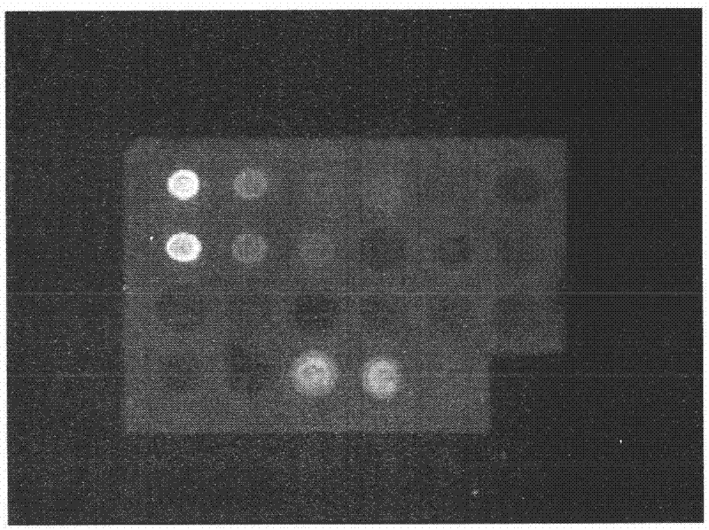 Preparation of multi-epitope TK-1 antibody, and application of multi-epitope TK-1 antibody in evaluating treatment effect on tumor patient