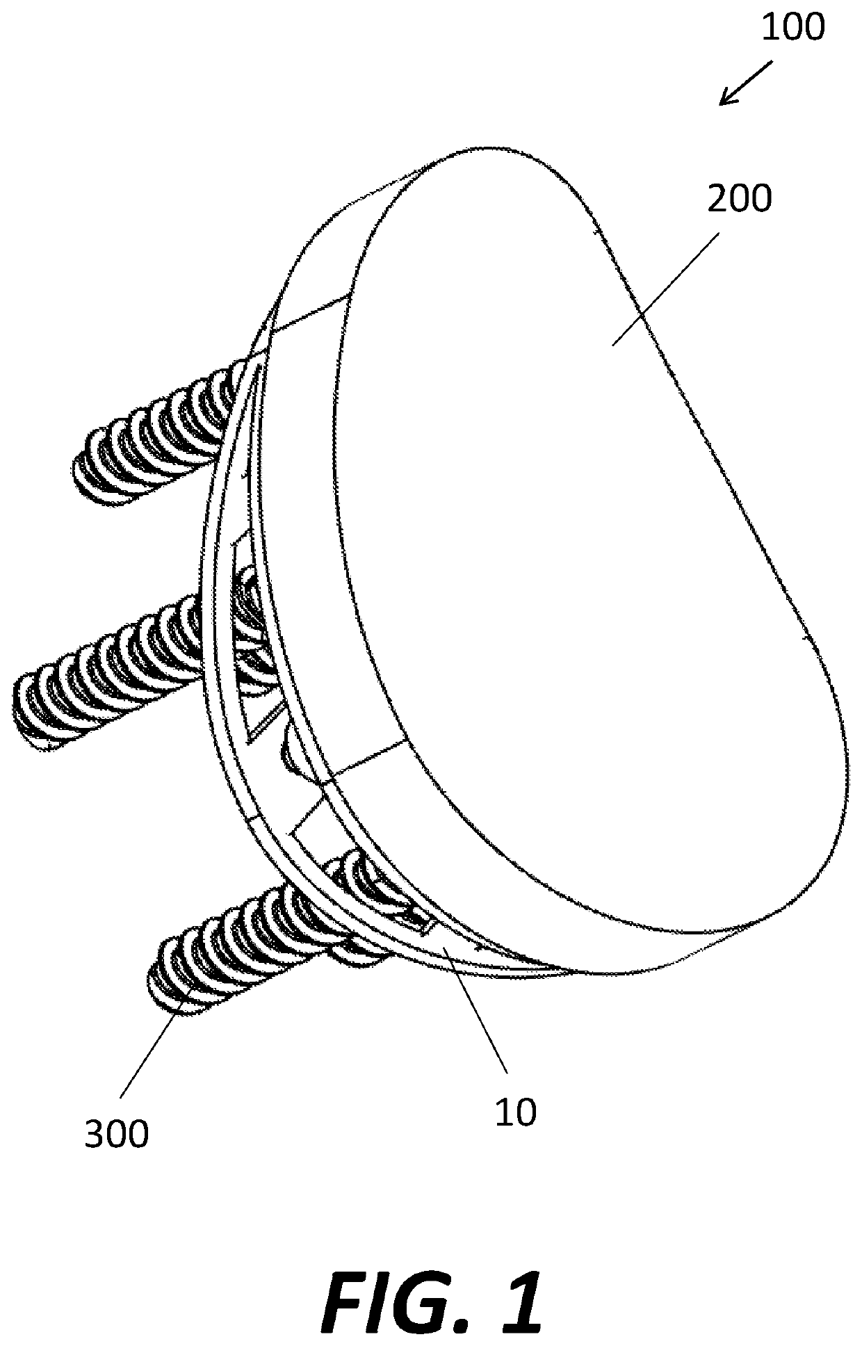 Truss Glenoid Augment