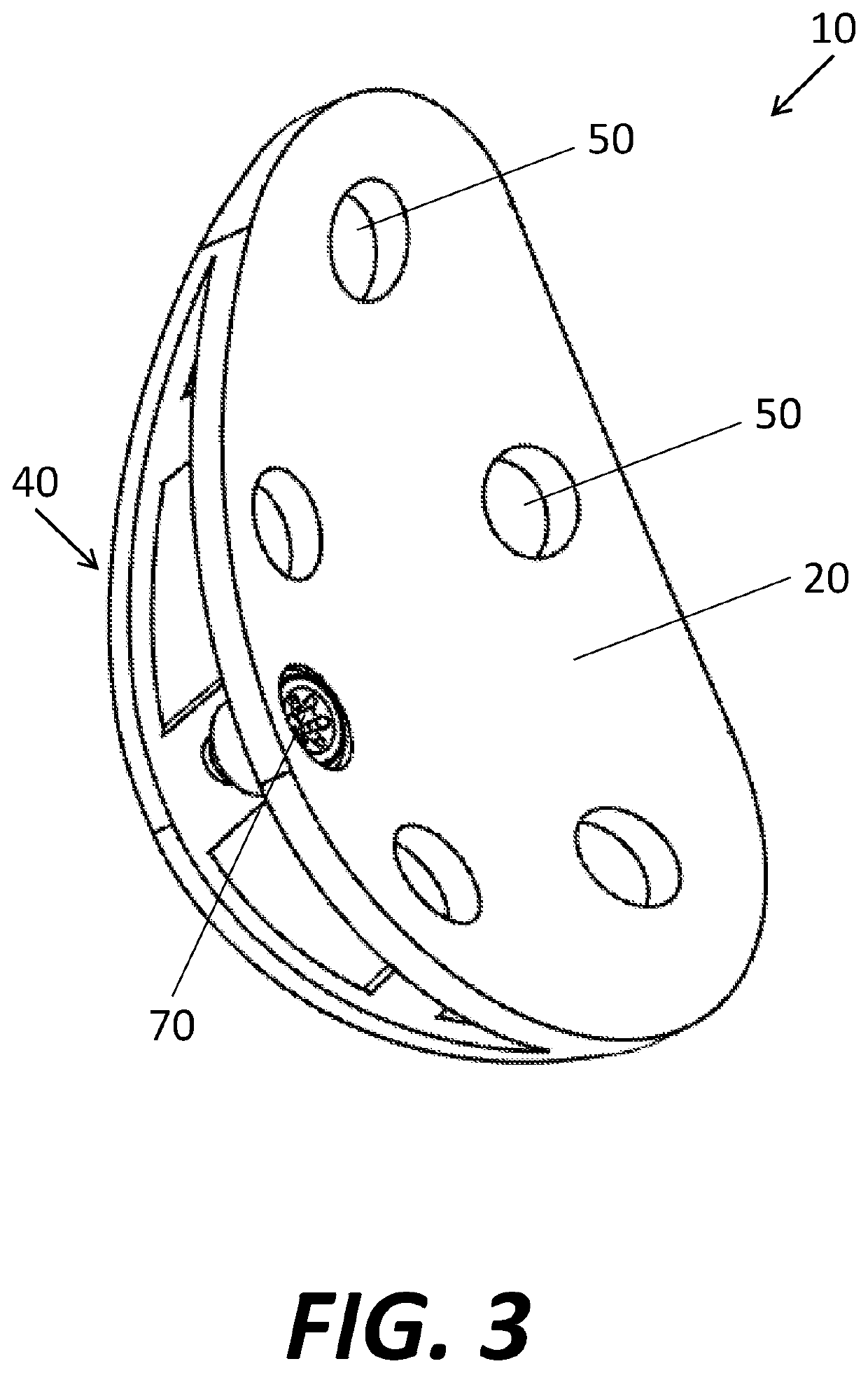 Truss Glenoid Augment